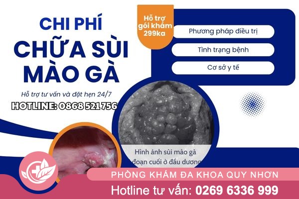 Chi phí chữa sùi mào gà