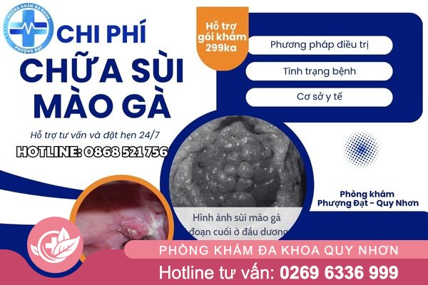 Chi phí xét nghiệm và chữa sùi mào gà