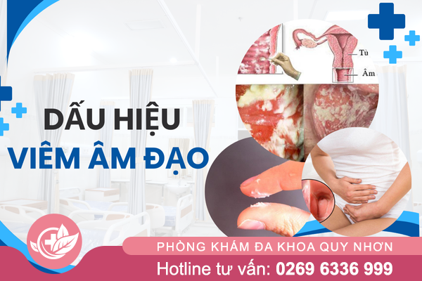 Dấu hiệu nhận biết viêm âm đạo