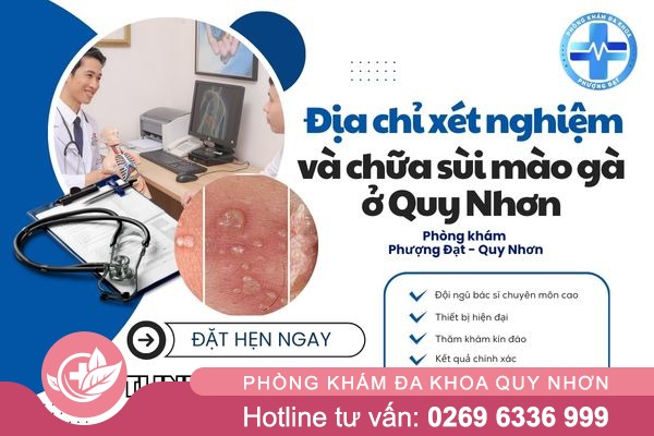 Địa chỉ xét nghiệm và chữa sùi mào gà ở Thị xã Hoài Nhơn uy tín