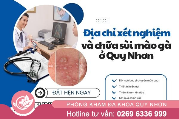 Địa chỉ xét nghiệm và chữa sùi mào gà ở Quy nhơn uy tín