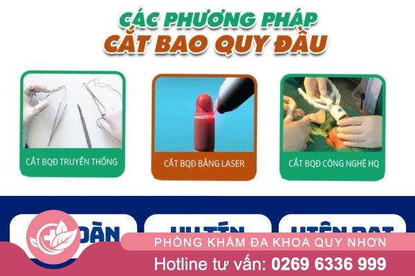 Các phương pháp cắt bao quy đầu an toàn 