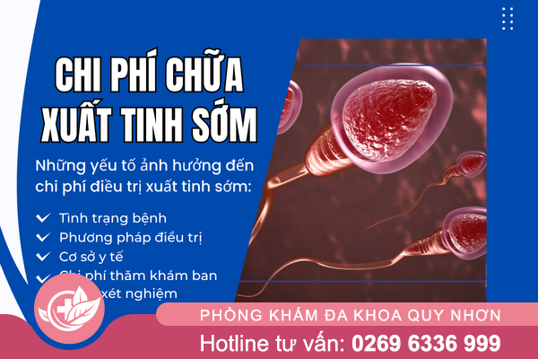 Chi phí chữa xuất tinh sớm là bao nhiêu?