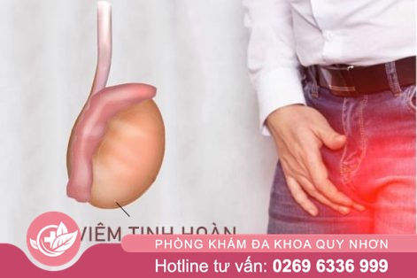 Địa chỉ điều trị viêm tinh hoàn uy tín, hiệu quả nhanh