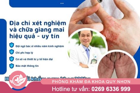 Địa chỉ xét nghiệm và chữa giang mai ở thị xã Sông Cầu hiệu quả