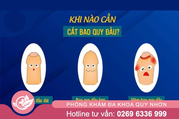 Khi nào cần cắt bao quy đầu