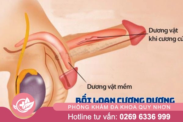 Rối loạn cương dương là gì?