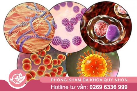 Chữa bệnh tình dục ở Huyện Vĩnh Thạnh hiệu quả – bảo mật nhất