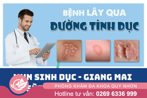 Chữa bệnh tình dục ở Huyện Phù Mỹ chính xác – an toàn nhất