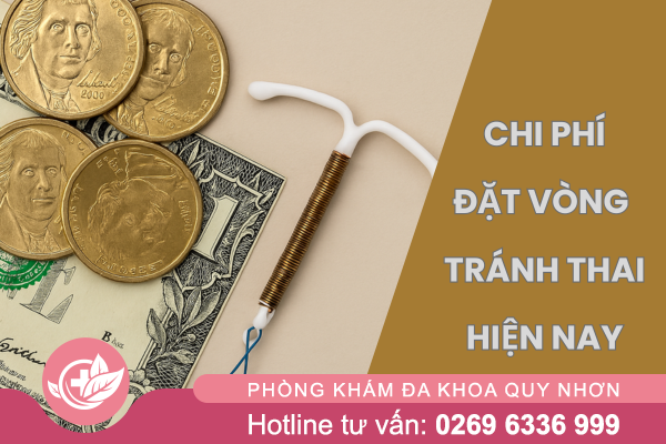 Chi phí đặt vòng tránh thai hiện nay tại Quy Nhơn