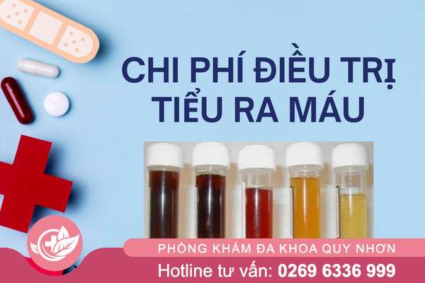 Chi phí điều trị tiểu ra máu