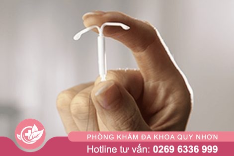 Đặt vòng tránh thai ở đâu tại Quy Nhơn uy tín?