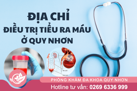 Địa chỉ chữa tiểu ra máu ở Quy nhơn an toàn – hiệu quả