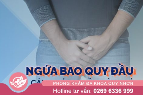 Ngứa bao quy đầu là bị bệnh gì?