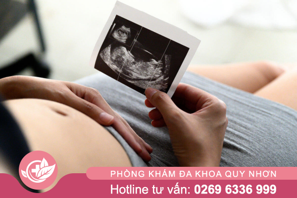 Siêu âm thai là gì?