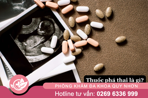 Thuốc phá thai là gì? 
