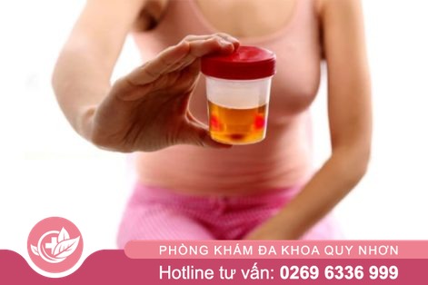 [Cảnh báo] Đi tiểu buốt ra máu là dấu hiệu bệnh gì? Cách chữa an toàn