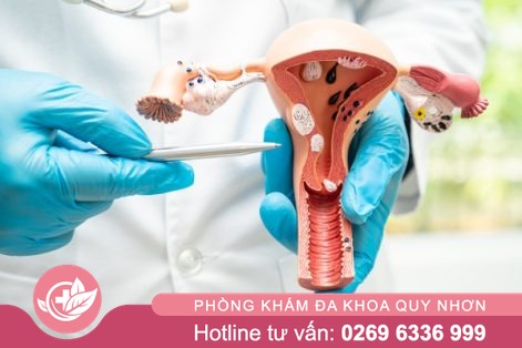 Ung thư cổ tử cung là gì? Hướng dẫn nhận biết và điều trị sớm hiệu quả