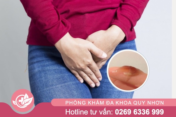 Khí hư màu nâu sau phá thai bằng thuốc nguy hiểm không?