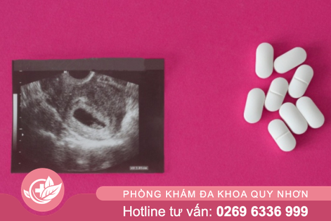 Phá thai bằng thuốc bao lâu có kinh lại?