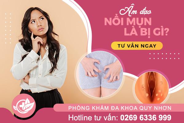 Mụn âm đạo có nguy hiểm không? Dấu hiệu cảnh báo bệnh lý phụ khoa