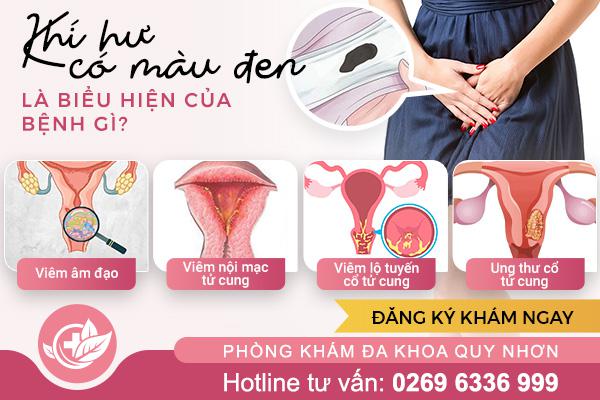 Khí hư có màu đen bất thường – Cảnh báo không nên bỏ qua