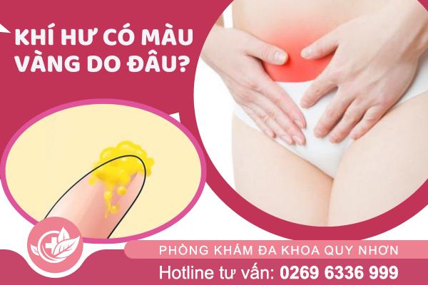 Ra dịch màu vàng là bị bệnh gì nguy hiểm không?