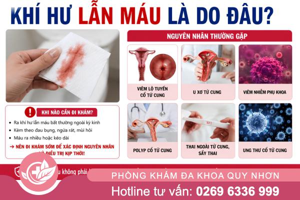 Khí hư lẫn máu – Dấu hiệu cơ thể đang cảnh báo điều gì?