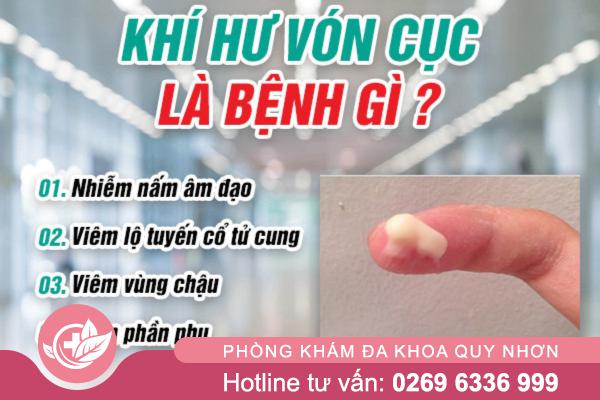 Khí hư vón cục – Cơ thể đang “lên tiếng” điều gì?