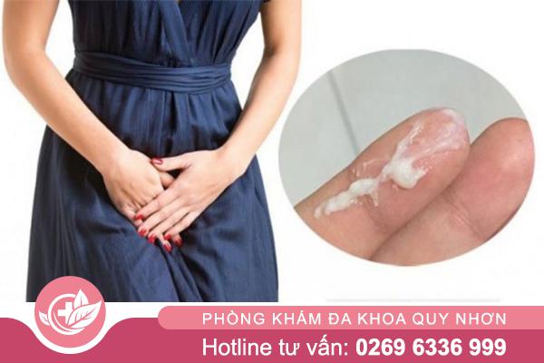 Dịch mủ vùng kín ở nữ giới: Dấu hiệu không thể bỏ qua