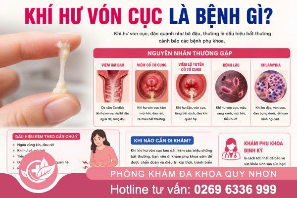 Khí hư vón cục – Cơ thể đang “lên tiếng” điều gì?