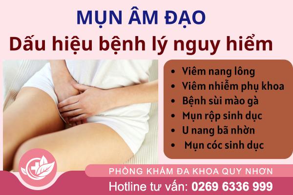 Mụn âm đạo có nguy hiểm không? Dấu hiệu cảnh báo bệnh lý phụ khoa