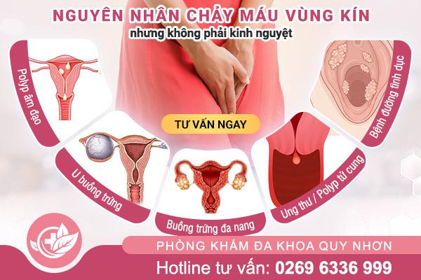 Thận trọng khi chảy máu vùng kín nhưng không phải kinh nguyệt