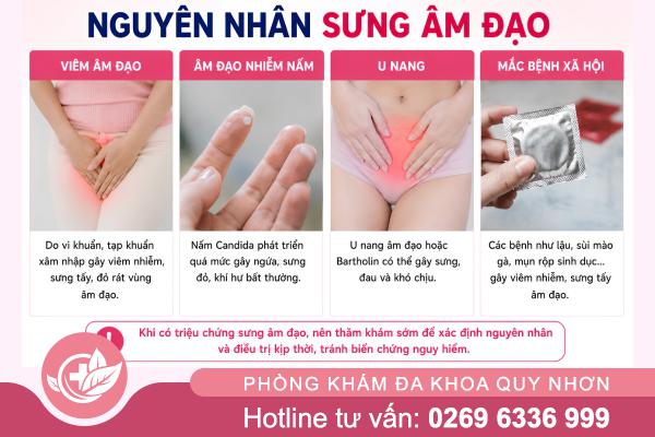 Sưng Âm Đạo Và Những Bất Thường Cần Được Khám Sớm
