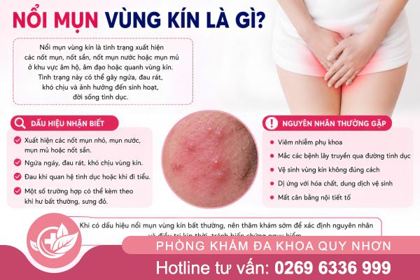 Mụn Vùng Kín: Nguyên Nhân Thường Gặp và Hướng Điều Trị