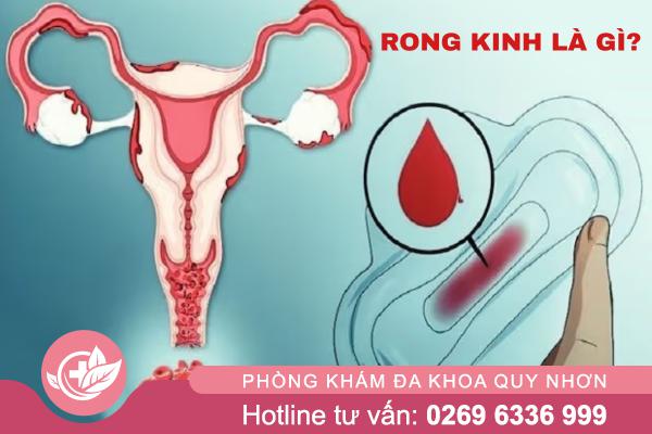 Rong kinh kéo dài: Dấu hiệu bệnh lý không nên chủ quan