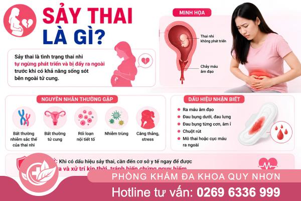Cảnh báo sảy thai: Các triệu chứng thường gặp không nên bỏ qua