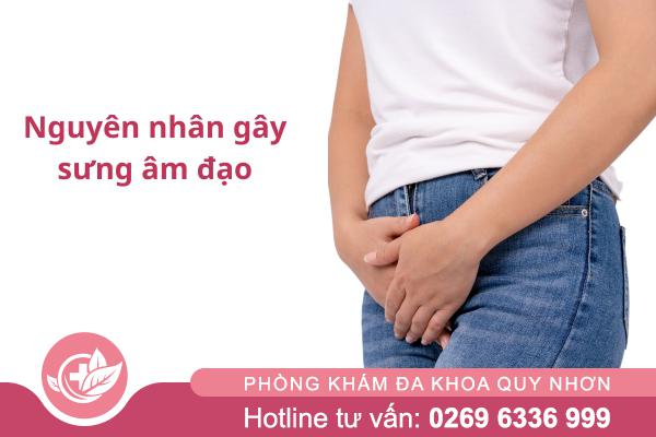 Sưng Âm Đạo Và Những Bất Thường Cần Được Khám Sớm