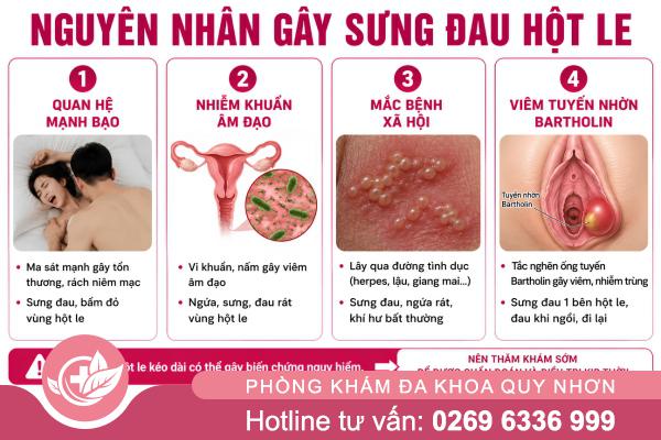 Sưng đau hột le: Dấu hiệu bất thường không nên chủ quan