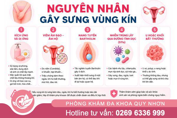 Tìm hiểu các vấn đề sức khỏe liên quan đến sưng vùng kín