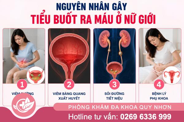 Tiểu buốt ra máu ở nữ là gì? Những điều không nên chủ quan