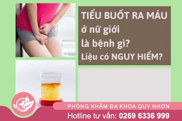 Tiểu buốt ra máu ở nữ là gì? Những điều không nên chủ quan