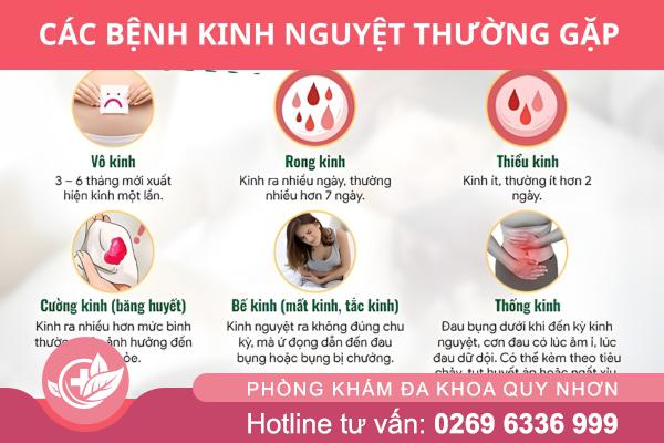 Vì Sao Nên Khám Bệnh Kinh Nguyệt Sớm?