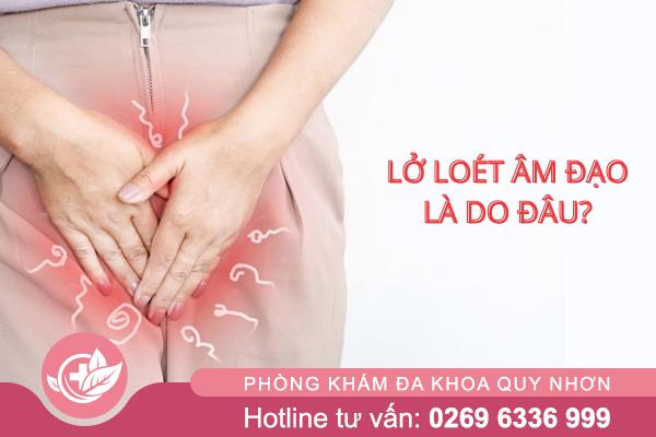 Lở loét âm đạo: Dấu hiệu nguy hiểm nhiều phụ nữ chủ quan