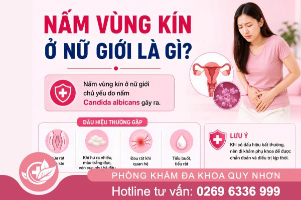 Trị nấm vùng kín hiệu quả, an toàn theo khuyến cáo bác sĩ
