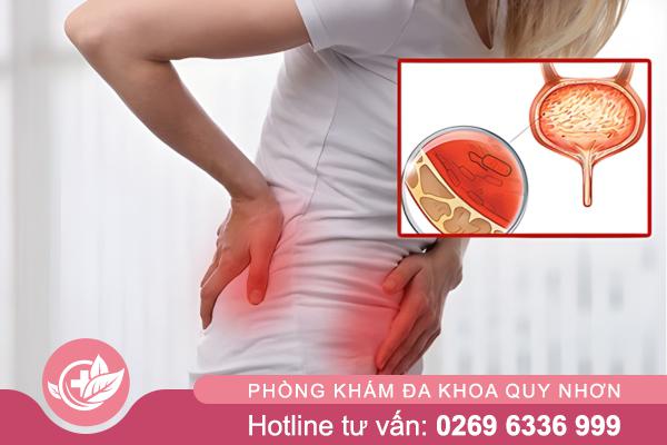 Viêm bàng quang ở nữ: Những điều cần biết