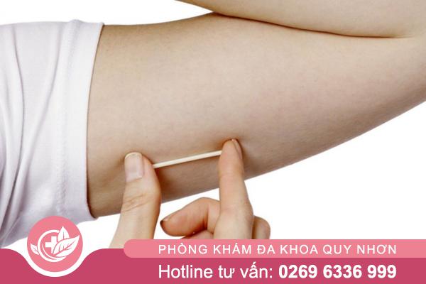 Có nên cấy que tránh thai? Những ai phù hợp với phương pháp này?