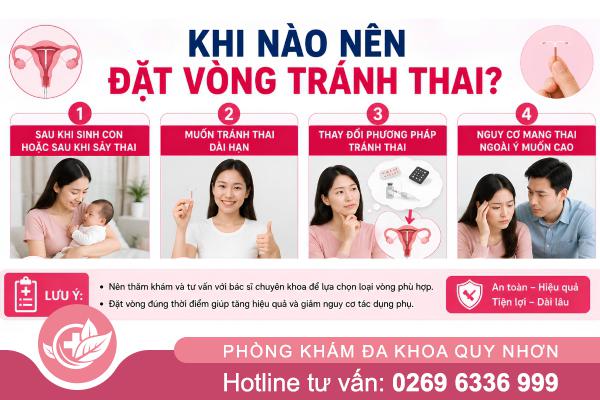 Địa chỉ đặt vòng ở Quy Nhơn có bác sĩ giỏi – Gợi ý cho bạn