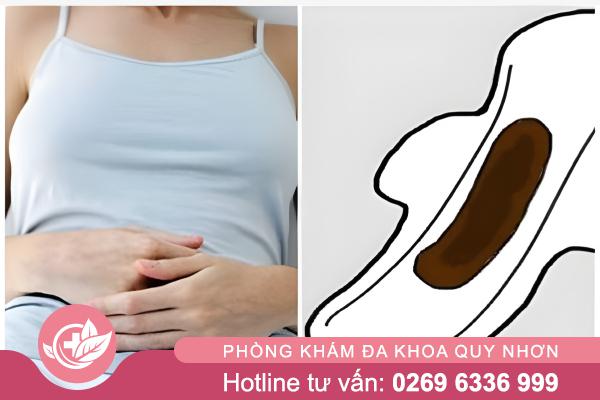 Rong kinh ra máu đen: Dấu hiệu cảnh báo bệnh phụ khoa cần lưu ý