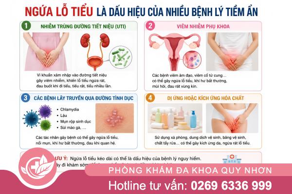 Ngứa lỗ tiểu là dấu hiệu bệnh gì? Hướng dẫn chăm sóc và điều trị